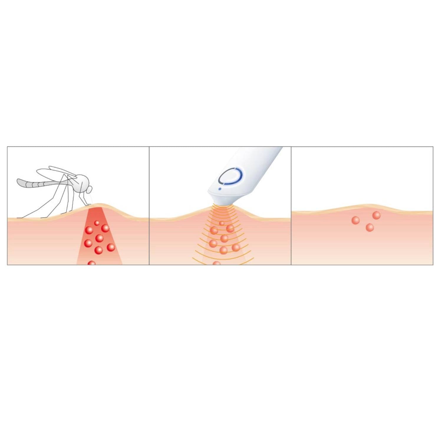 Insektbid lindring (forebyg hævelse, kløe)