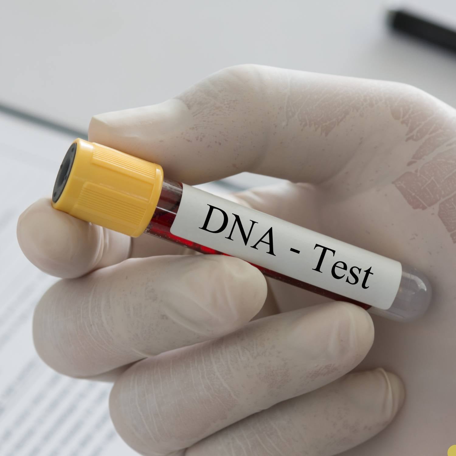 Skimmelsvamp Test (DNA prøve)